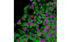Coherent Raman scattering imaging (CRI) for Chemical Industry