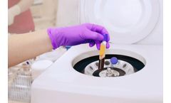 Fresh Frozen Plasma Storage