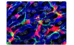 Portable Handheld Ultrasound Technology for Viral & Autoimmune Liver Disease Patients
