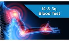 10 Years of Peer-Reviewed Studies Predicting and Informing the Prognosis Profile of Autoimmune Patients