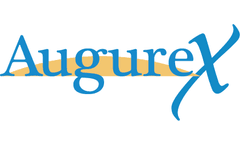 Serum 14-3-3&#951; A Predictor Of Secondary Sjögren’s Syndrome In SLE