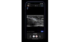 Ultrasound for Emergency Medicine