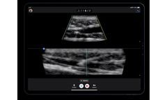 Ultrasound for EMS