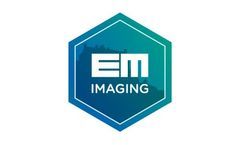 Molecular Fluorescence Endoscopy of (PRE)Malignant Esophageal Lesions (NL) - Case study