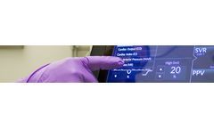 Multi-Beat Analysis Technology (MBA) for Clinical Impact