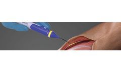 Healthy peripheral nervous system for nerve assessment sector