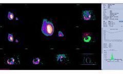 D-SPECT for Clinical Care - ERNA