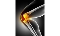 Knee Osteoarthritis