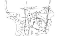 Submitting Models for Panthera Obstructive Sleep Apnea Device