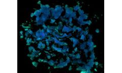 3D bioprinting technology for ovaries disease