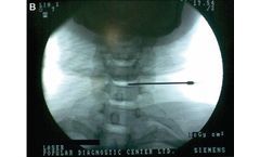 Medical solutions for neurosurgery sector