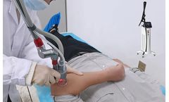 The CO2 fractional laser skin resurfacing in action