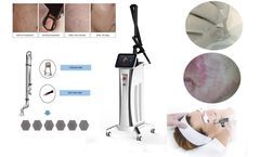 CO2 fractional laser treatment facial skin problems