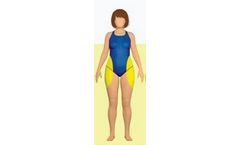 Medical Devices for Lipedema