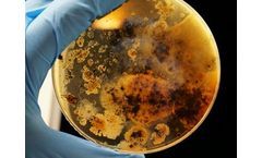 Pipeline for Infectious Diseases