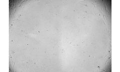 Serum Products for Mesenchymal Stem Cells Growth