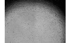 Serum Products for Fibroblasts Cell Growth