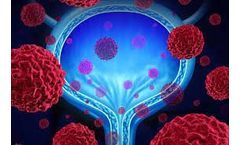 Phase III trial with Nubeqa (darolutamide) in combination with docetaxel and androgen deprivation therapy meets primary endpoint of significantly increasing overall survival in patients with metastatic hormone-sensitive prostate cancer