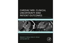 Cardiac MRI