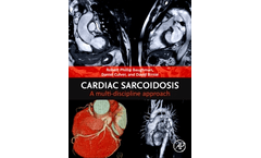 Cardiac Sarcoidosis