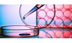 Abzymes Research is a New Field of Enzyme Engineering